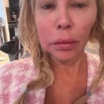 Todos los Brandi Glanville dijeron sobre la confusión de su rostro